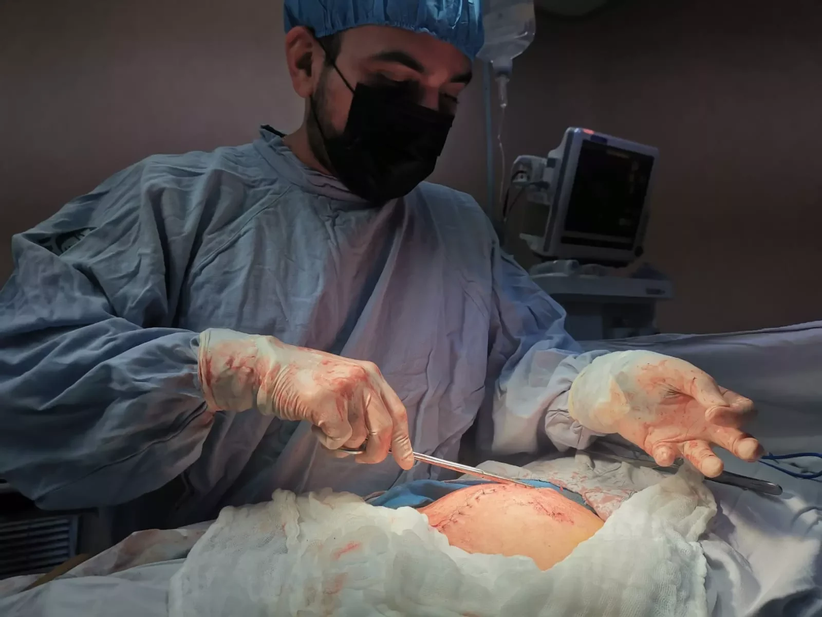 Procedimiento de cirugía abierta, Hospital Amerimed, Mérida, Yucatán