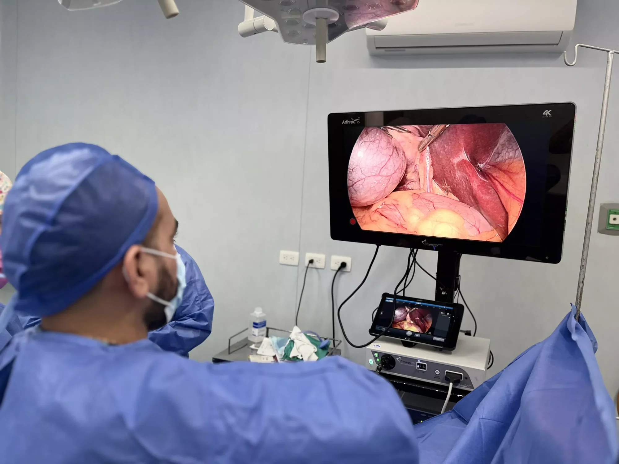 Cirugía laparoscópica guiada por cámara en monitor, Hospital Amerimed, Mérida, Yucatán